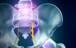 spine-surgery-sciatica-treatment